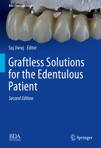 Graftless Solutions for the Edentulous Patient (BDJ Clinician’s Guides)