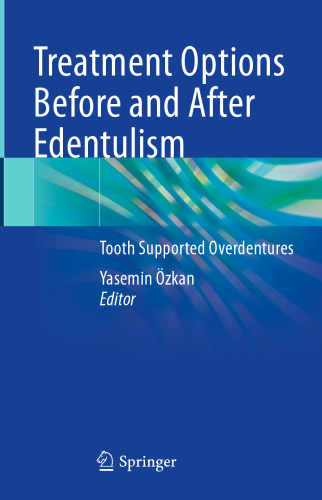 Treatment Options Before and After Edentulism: Tooth Supported Overdentures