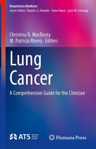 Lung Cancer: A Comprehensive Guide for the Clinician (Respiratory Medicine)