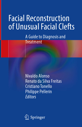 Facial Reconstruction of Unusual Facial Clefts: A Guide to Diagnosis and Treatment