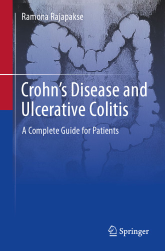 Crohn's Disease and Ulcerative Colitis: A Complete Guide for Patients