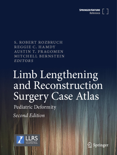 Limb Lengthening and Reconstruction Surgery Case Atlas: Pediatric Deformity