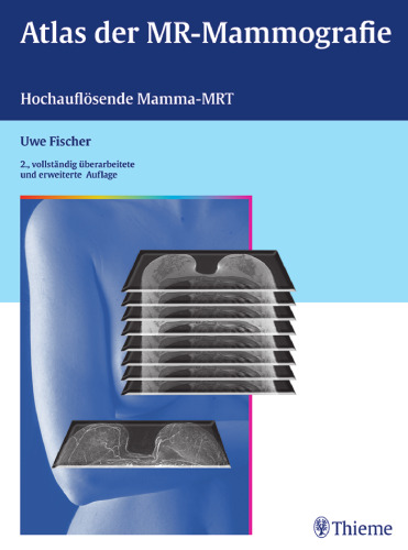 Atlas der MR-Mammographie: Hochauflösende Mamma-MRT