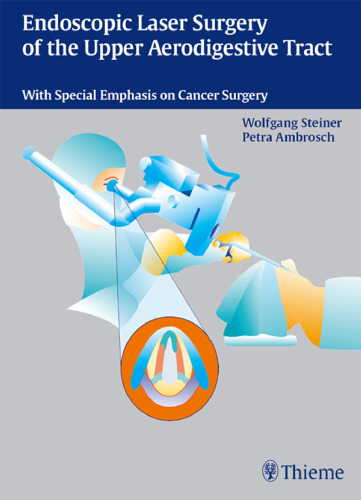 Endoscopic laser surgery of the upper aerodigestive tract: with special emphasis on cancer surgery
