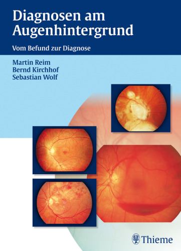 Diagnosen am Augenhintergrund
