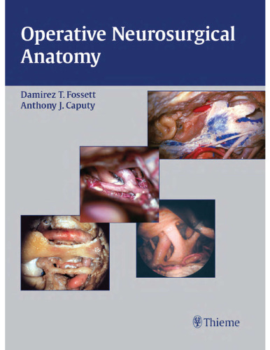 Operative Neurosurgical Anatomy