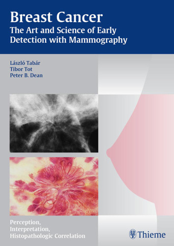 Breast cancer: the art and science of early detection with mammography: perception, interpretation, histopathologic correlation