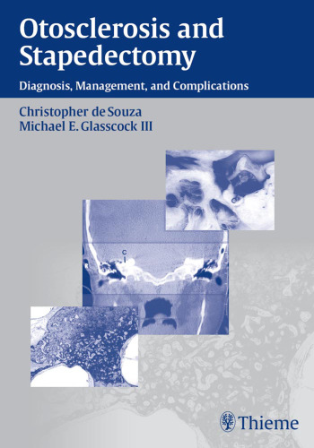 Otosclerosis and stapedectomy: diagnosis, management, and complications