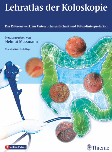 Lehratlas der Koloskopie: Das Referenzwerk zur Untersuchungstechnik und Befundinterpretation