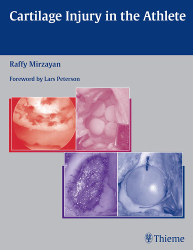 Cartilage injury in the athlete