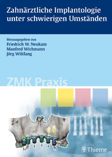 Zahnärztliche Implantologie unter schwierigen Umständen (ZMK Praxis)