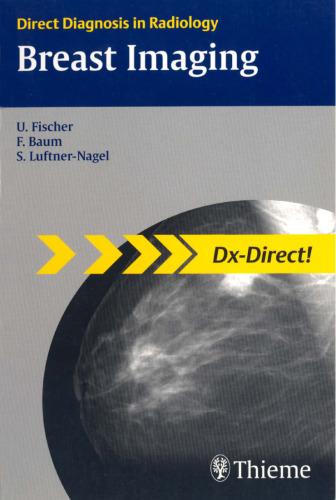 Breast imaging ( DX-Direct )