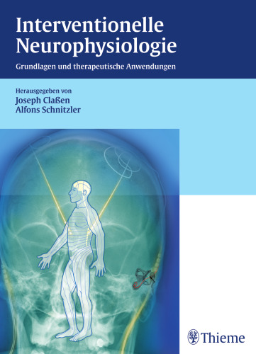 Interventionelle Neurophysiologie: Grundlagen und therapeutische Anwendungen