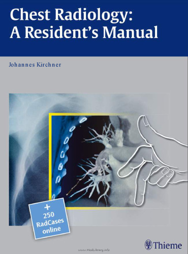 Chest Radiology: A Resident's Manual