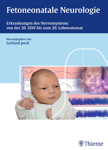 Fetoneonatale Neurologie: Erkrankungen des Nervensystems von der 20. SSW bis zum 20. Lebensmonat