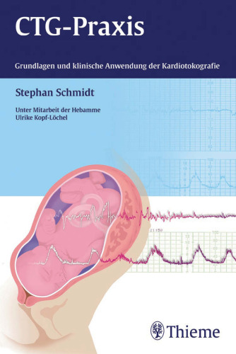 CTG-Praxis: Grundlagen und klinische Anwendung der Kardiotokografie