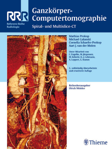 Ganzkörper-Computertomographie: Spiral- und Multislice-CT