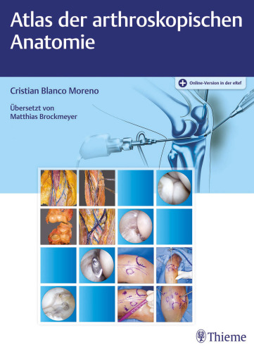 Atlas der arthroskopischen Anatomie