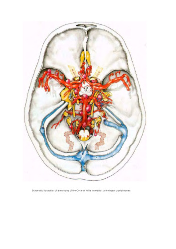 Microneurosurgery: volume. 2