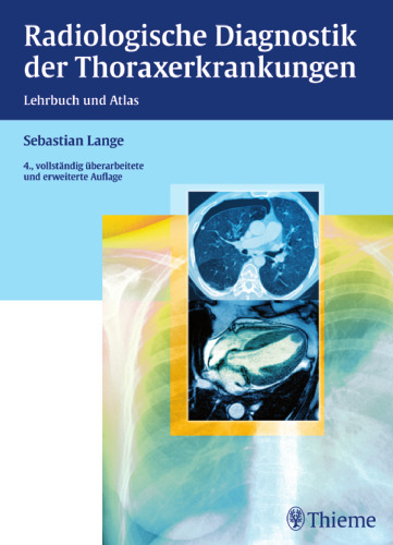 Radiologische Diagnostik der Thoraxerkrankungen