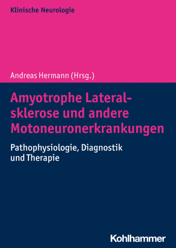 Amyotrophe Lateralsklerose und andere Motoneuronerkrankungen: Pathophysiologie, Diagnostik und Therapie