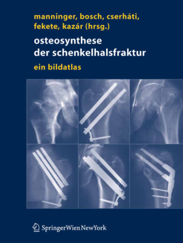 Osteosynthese der schenkelhalsfraktur : ein bildatlas