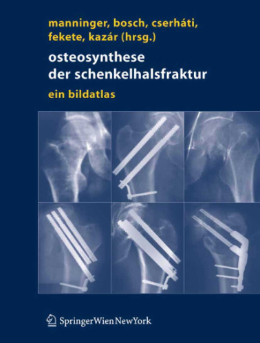 Osteosynthese der schenkelhalsfraktur : ein bildatlas