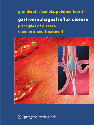 Gastroesophageal Reflux Disease: Principles of Disease, Diagnosis, and Treatment
