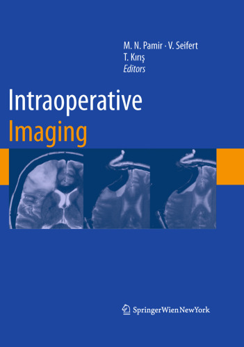 Intraoperative Imaging (Acta Neurochirurgica Supplementum, Volume 109)