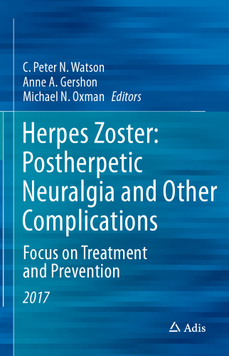 Herpes Zoster: Recent Aspects of Diagnosis and Control