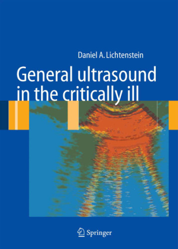 General Ultrasound in the Critically Ill