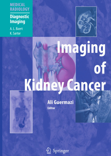 Imaging of Kidney Cancer (Medical Radiology)