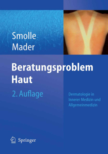 Beratungsproblem Haut: Dermatologie in Innerer Medizin und Allgemeinmedizin