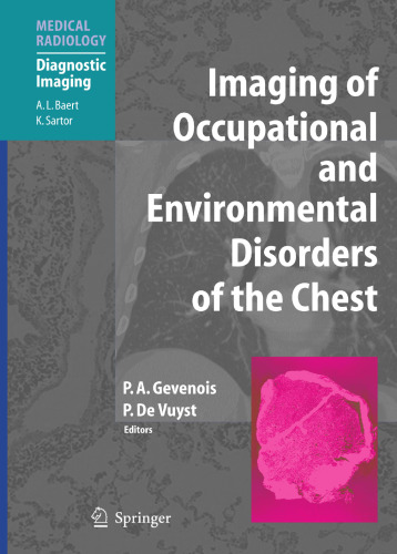Imaging of Occupational and Environmental Disorders of the Chest (Medical Radiology)