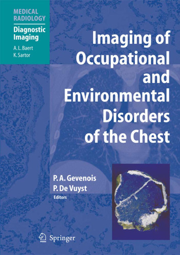Imaging of Occupational and Environmental Disorders of the Chest (Medical Radiology Diagnostic Imaging)