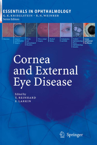 Cornea and external eye disease