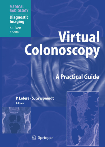 Virtual Colonoscopy: A Practical Guide