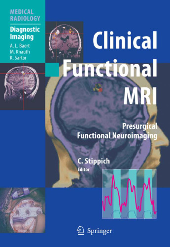 Clinical Functional MRI: Presurgical Functional Neuroimaging (Medical Radiology Diagnostic Imaging)