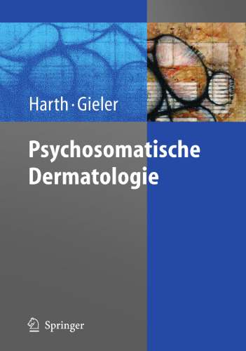 Psychosomatische Dermatologie (German Edition)