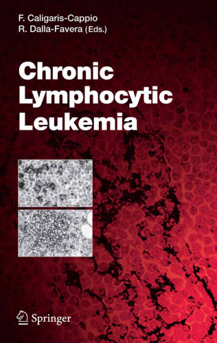 Chronic Lymphocytic Leukemia