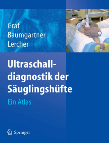 Ultraschalldiagnostik der Säuglingshüfte: Ein Atlas