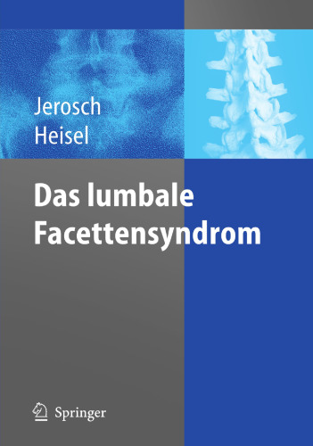 Das lumbale Facettensyndrom (German Edition)
