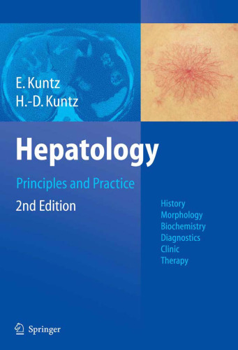 Hepatology, Principles and Practice: History, Morphology, Biochemistry, Diagnostics, Clinic, Therapy