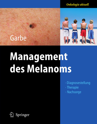 Management des Melanoms (Onkologie aktuell) (German Edition)