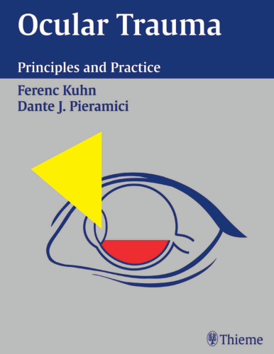 Ocular Trauma - Principles and Practice