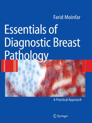 Essentials of Diagnostic Breast Pathology: A Practical Approach