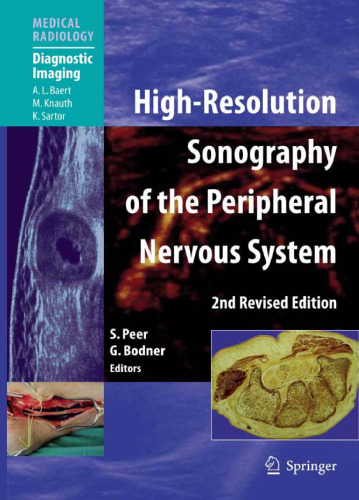 High-Resolution Sonography of the Peripheral Nervous System (Medical Radiology Diagnostic Imaging)
