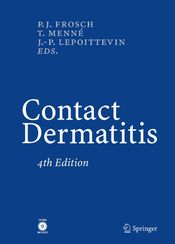 Textbook of Contact Dermatitis