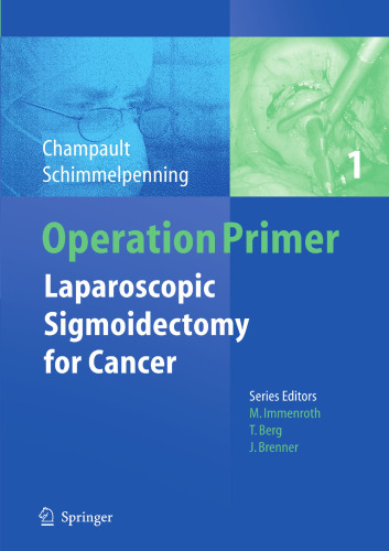 Laparoscopic Sigmoidectomy for Cancer