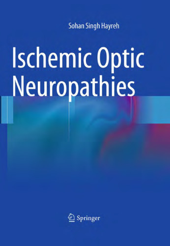Ischemic Optic Neuropathies